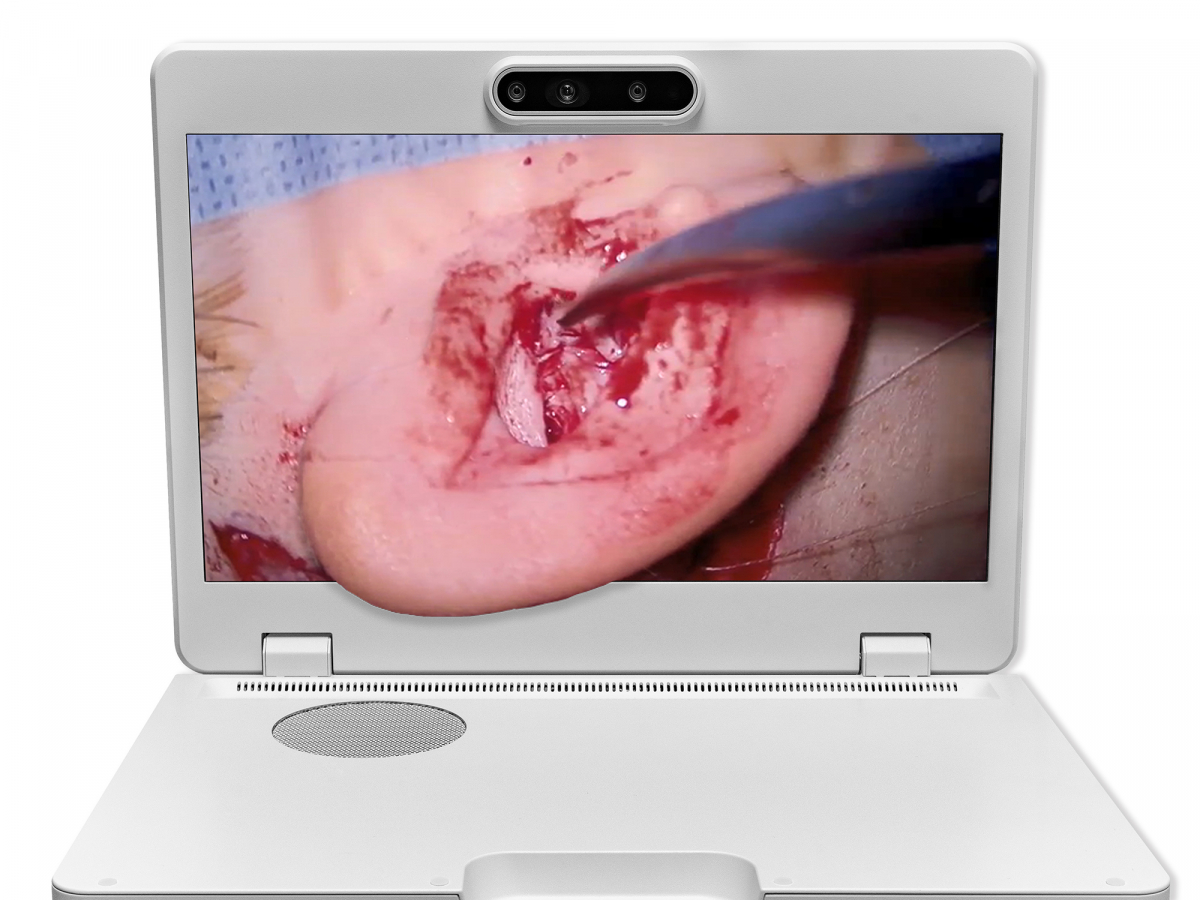 达擎之＂Heads-up 3D显微手术显示系统＂，整合4K裸眼3D显示及眼球追踪系统，具备快速追踪人眼移动位置功能，减轻医师长时间维持固定姿势的负担，让医师能有更宽广清晰的3D立体视野及更舒适的姿势来执行手术。